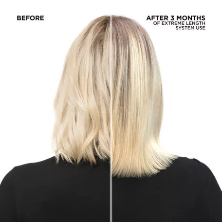 Redken - Extreme Length Conditioner - professzionális kondícionáló - 300 ml