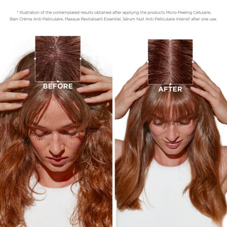 Kérastase SYMBIOSE Micro-Peeling Cellulaire - mikro-hámlasztó celluláris ápoló - 200 ml