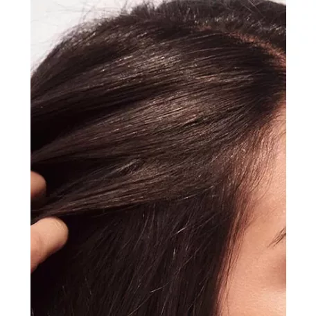 WELLA INVIGO Scalp Balance Oily Scalp - sampon zsíros fejbőrre 1000 ml